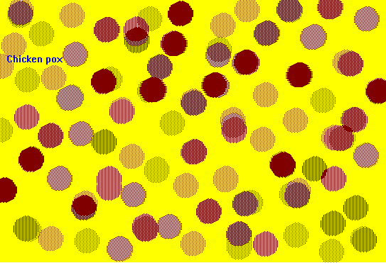 chicken-pox
